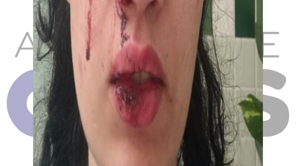 Mulher denuncia agressão de bombeiro militar em Assis. Caso é investigado sob a Lei Maria da Penha e Justiça avalia prisão preventiva do suspeito.