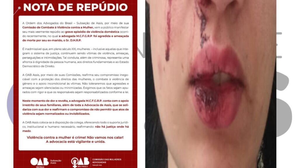 OAB Assis repudia agressão a advogada por ex-marido bombeiro militar e cobra responsabilização. Entidade oferece apoio jurídico e institucional à vítima.