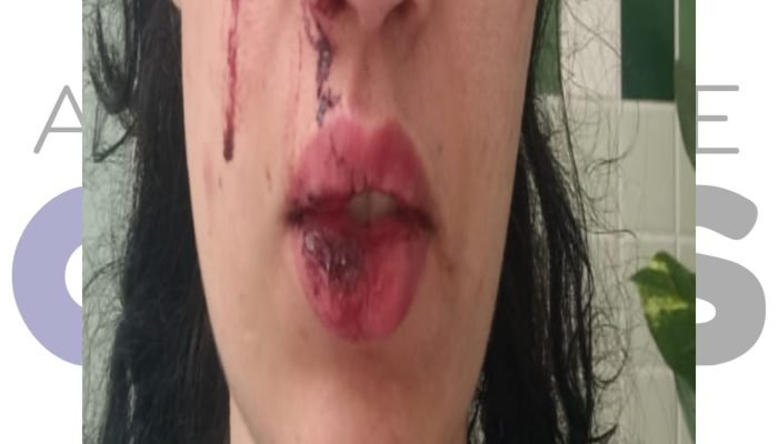 Mulher denuncia agressão de bombeiro militar em Assis. Caso é investigado sob a Lei Maria da Penha e Justiça avalia prisão preventiva do suspeito.